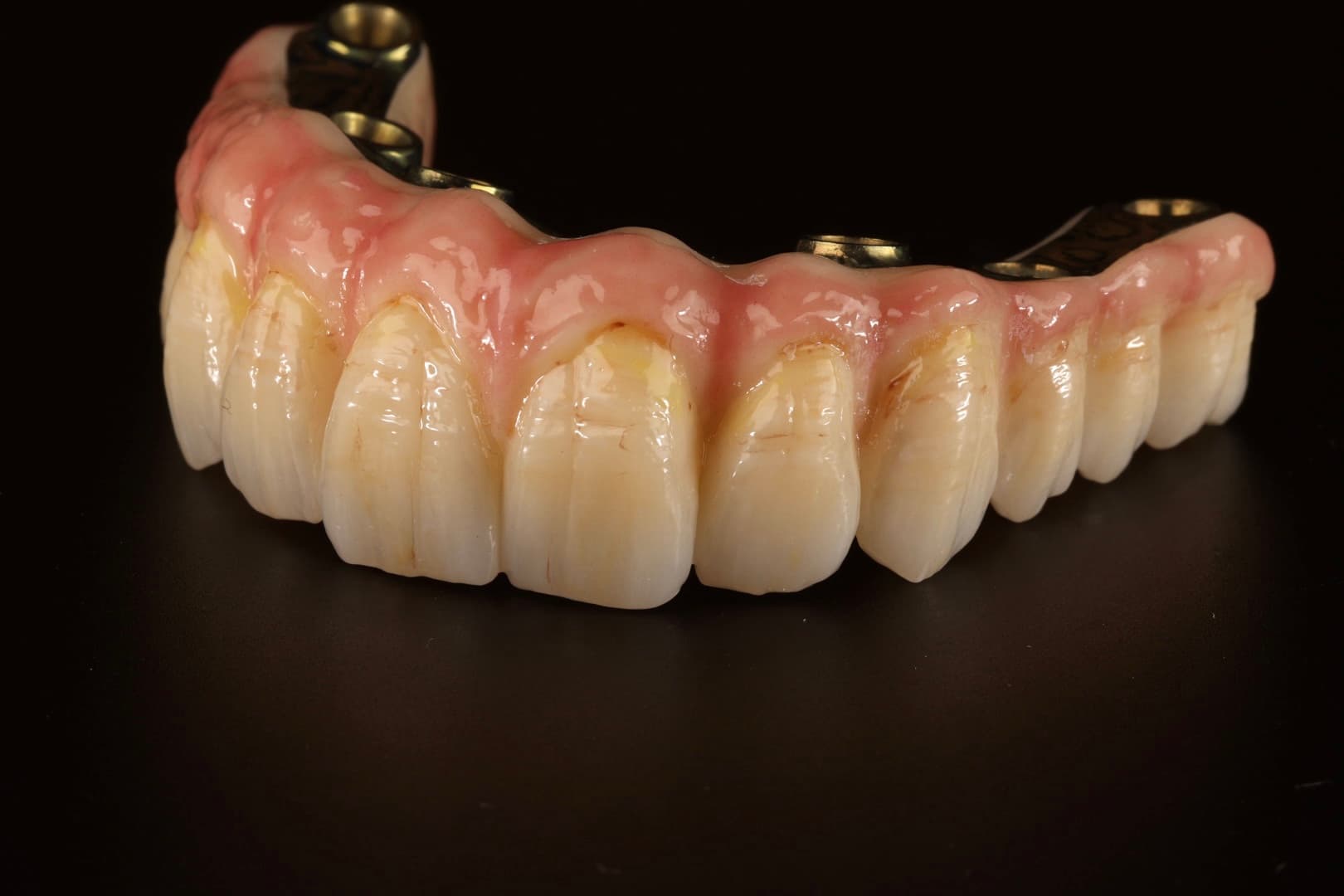 Dental Implant 6